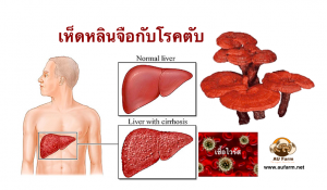 Reishi with liver disease